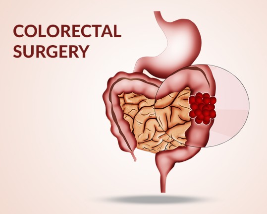 Dr Anil Heroor Surgical Oncologist Colorectal Cancer